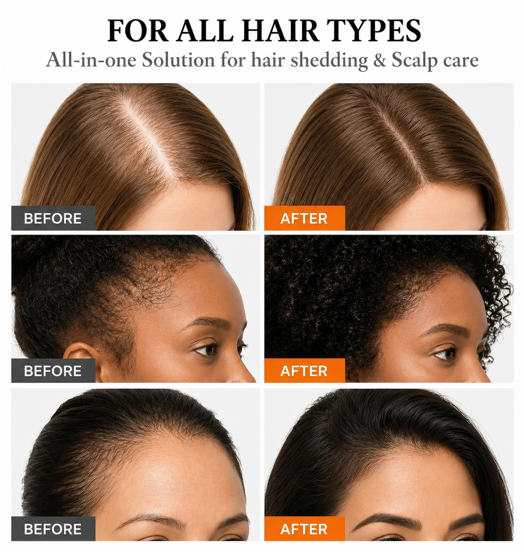 NYRA™ Korean Hair Growth Serum
